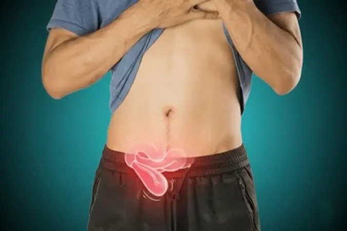 Expert Hernia Surgeon in Delhi - Expert laparoscopic surgery in Delhi, India by Dr. Kapil Agrawal